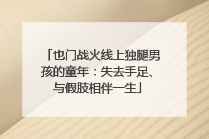 也门战火线上独腿男孩的童年：失去手足、与假肢相伴一生
